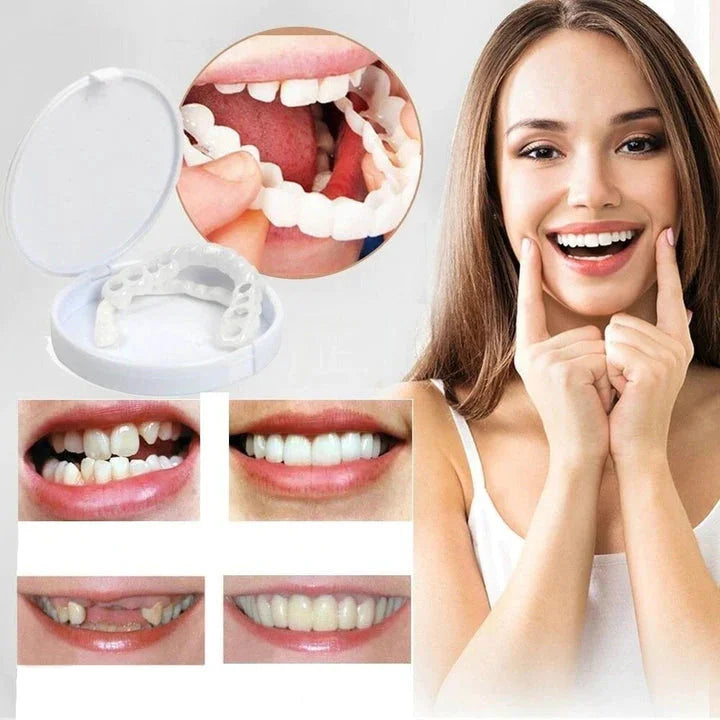 Snap on Smile Veneers - Instant Dental Transformation for Perfect Teeth