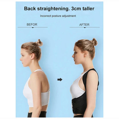Adjustable Posture Corrector – Ergonomic Back Support for Men & Women