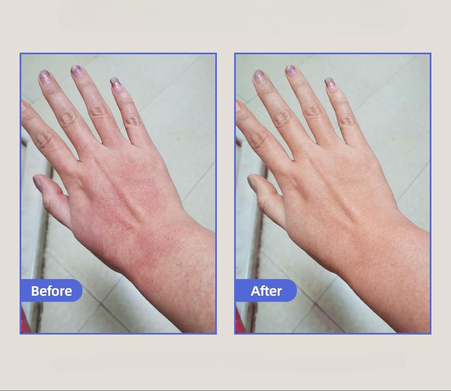 Healed My Eczema - Soothing Cream for Calming & Restoring Irritated Skin