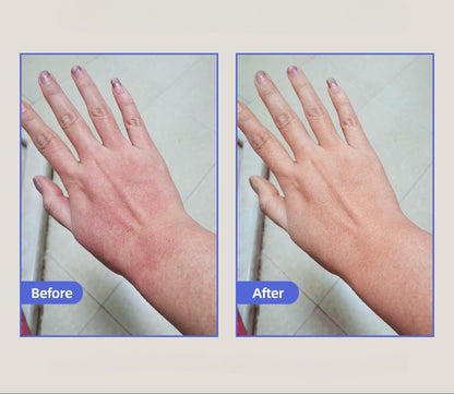 Healed My Eczema - Soothing Cream for Calming & Restoring Irritated Skin